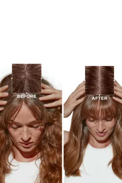 Bain crème anti-pelliculaire Symbiose