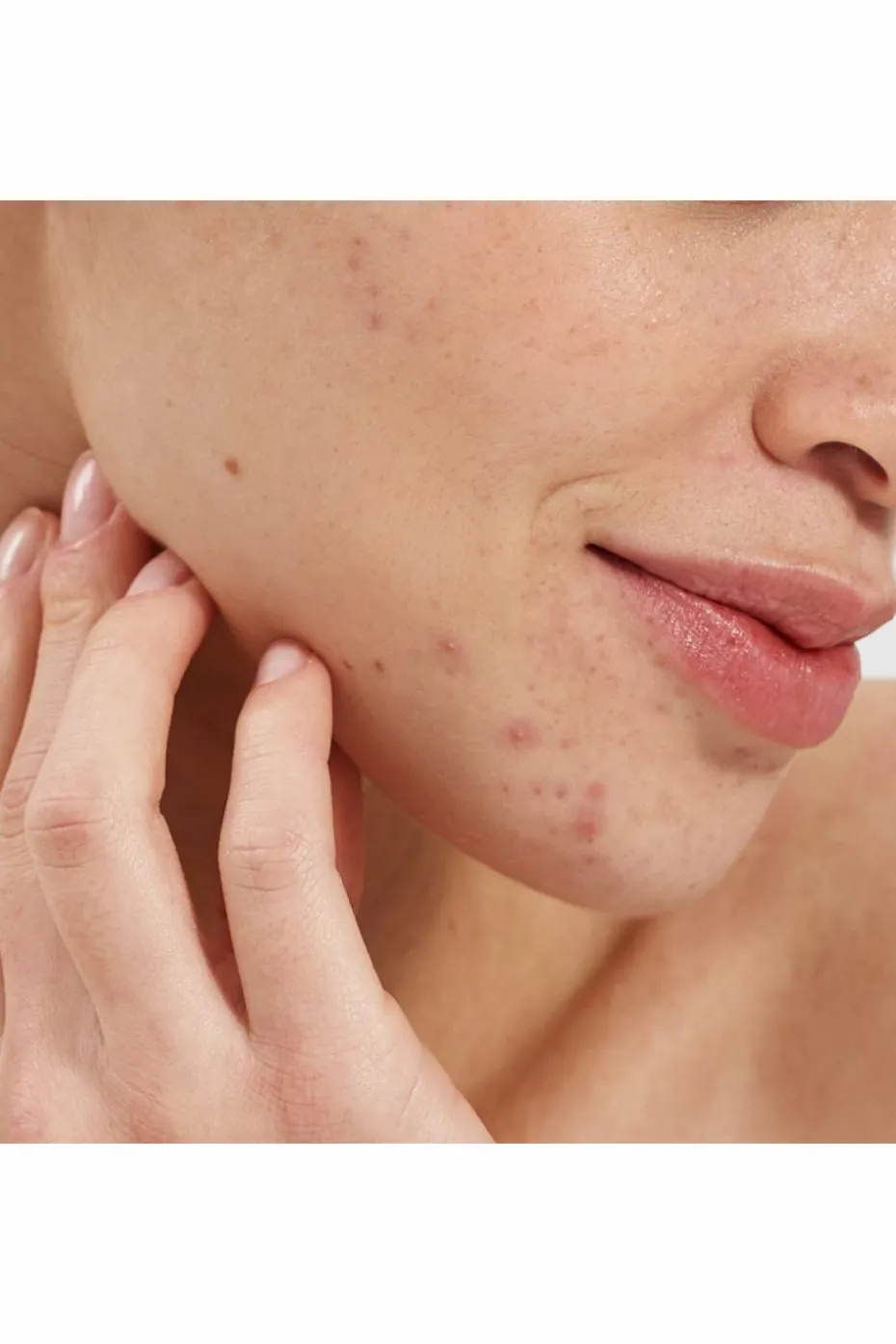 Booster purifiant à l’acide salicylique