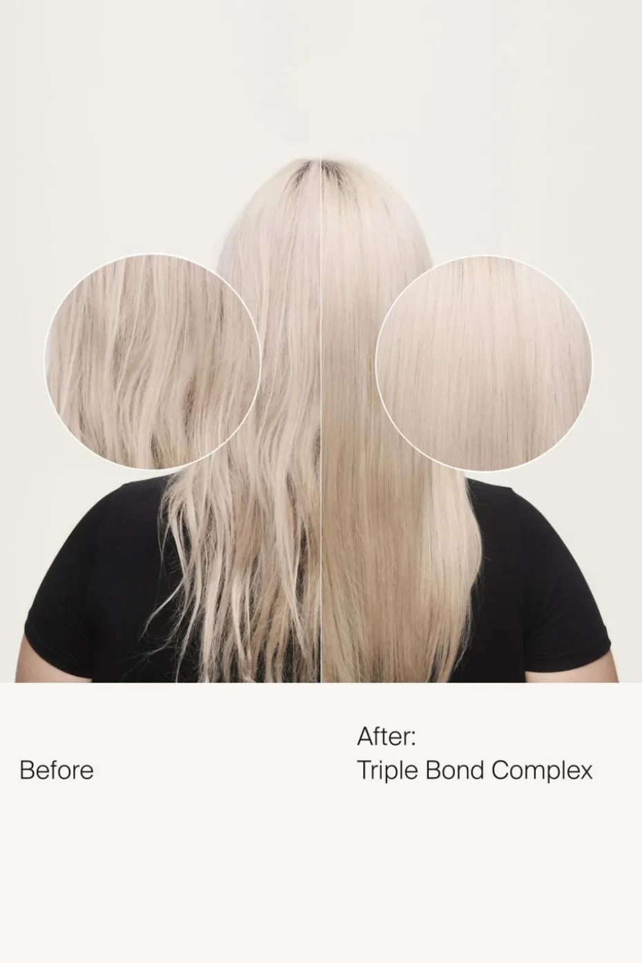 Complexe triple liaison