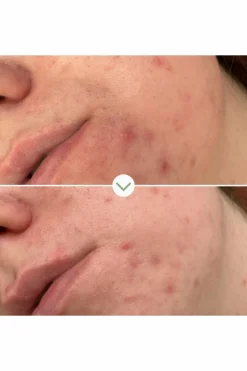 Gel nettoyant purifiant Phaze