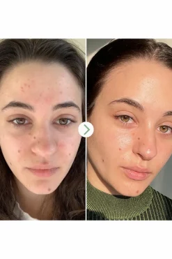 Huile de nuit anti-imperfections Carbon Star