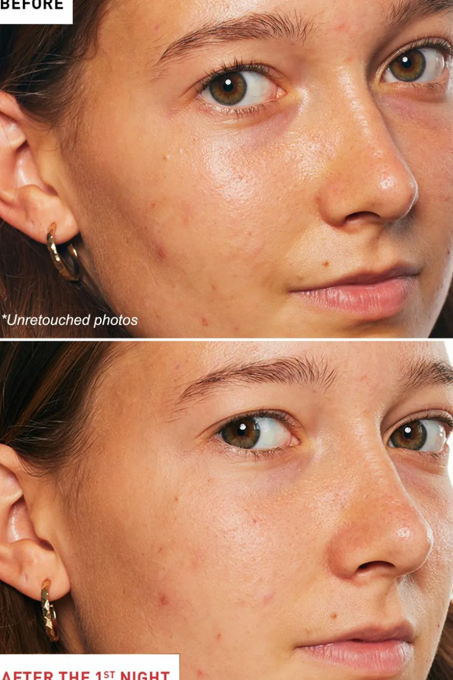 Huile de nuit multi-perfectrice Skin Therapy