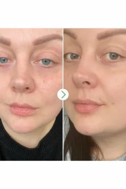 Huile visage universelle Rosehip BioRegenerate