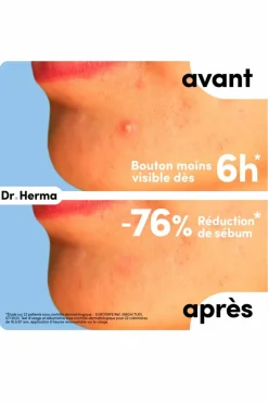 Patch anti-boutons format petit