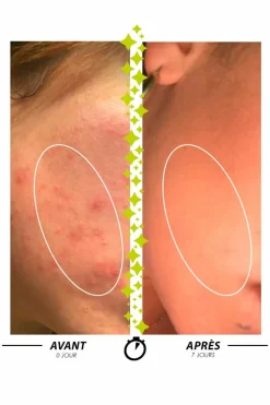 Pâte purifiante anti-imperfections Sulfureuse Pâte du Marabout