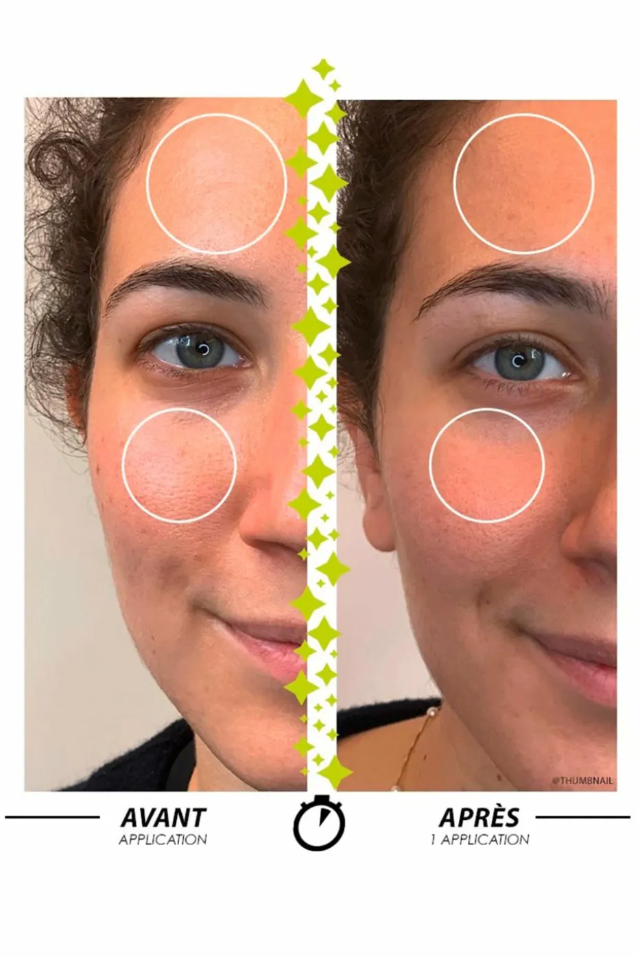 Roll-on anti-imperfections Marabou-T