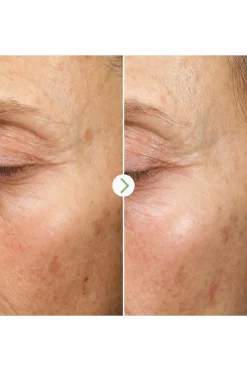 Sérum anti-taches aux algues marines Fade Forward