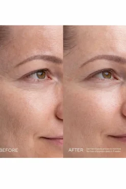 Sérum anti-taches Kojic alternative