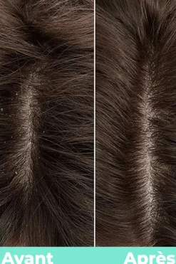 Sérum détox cure SOS pour cuir chevelu hydra équilibrant