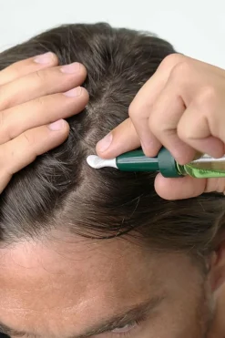 Traitement antichute 8 doses Triphasic Progressive